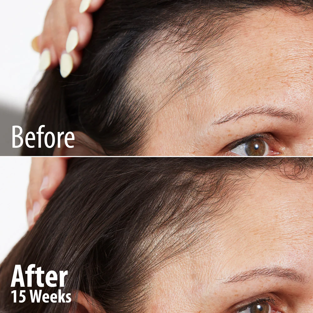 Age Reverse Collagen Peptides Powder : Bundle Offer - Image 2
