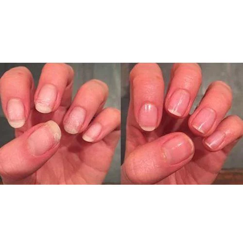 Pink Armour Nail Gel - Buy 1 Get 1 Free - Image 4